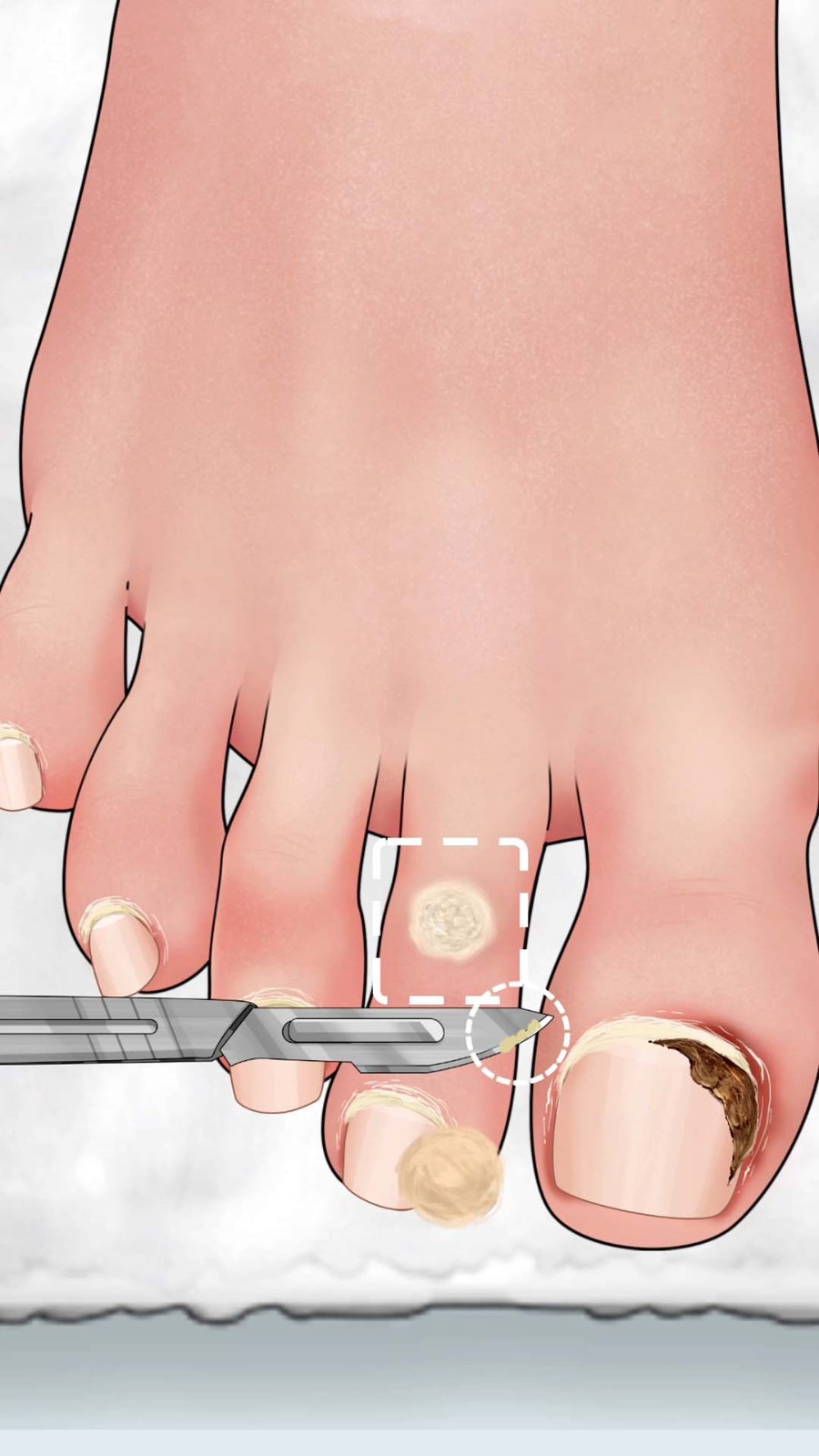 修脚高手模拟器截图2